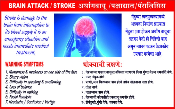 brain attack stroke hesi case study